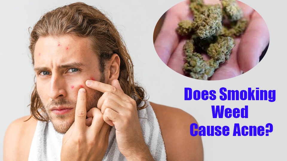 Does Smoking Weed Cause Acne