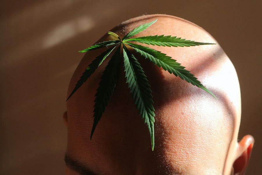 Hair-Loss-Cannabis