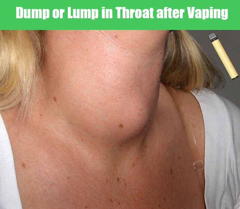 lump in throat after smoking cigarettes What are the types of cancer smokers vs. Non-smokers? Effects of Smoking on Your